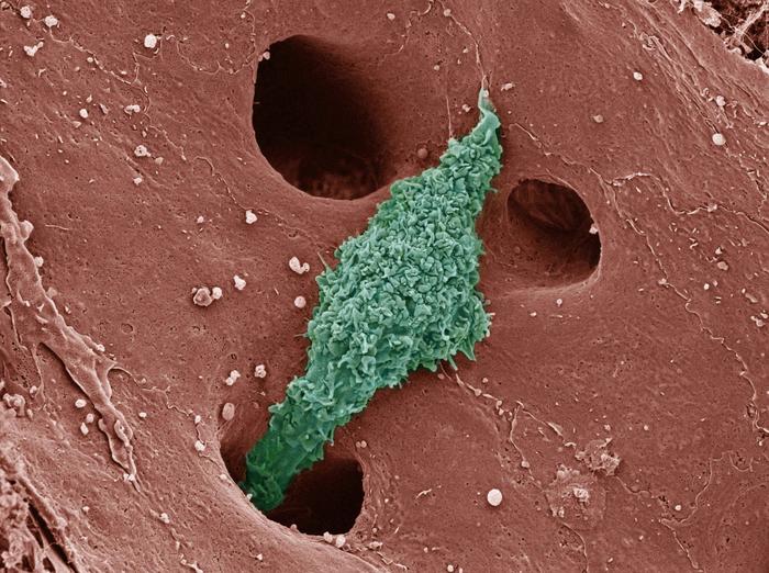 A colorized scanning electron micrograph depicts a Kupffer cell. These immune system cells reside only in the liver, protecting other cells by detecting and removing foreign debris, dead cells and pathogens. They also pay a role in the metabolism of many different compounds, including lipids and protein complexes.