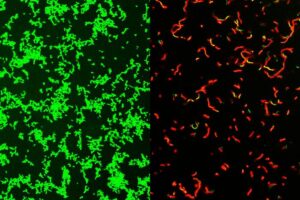 Researchers at Washington University School of Medicine in St. Louis have developed a compound that is effective against common bacteria that can lead to rare, dangerous illnesses. This image shows untreated Streptococcus pyogenes bacterial culture full of healthy microbes, labeled green (left). After treatment by GmPcide, the dish is full of dead bacteria (red; right).