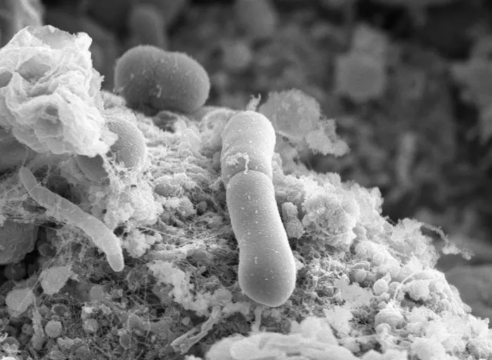 Scanning Electron Microscopy image of C. difficile in the gut of an infected animal - The University of Sheffield