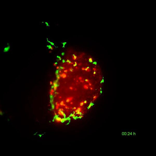 Still image from a 21-hour video showing a human bladder tumour (red) being cleared by zebrafish macrophages (green)