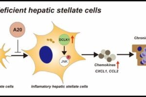 Loss of A20 function in hepatic stellate cells upregulated the DCLK1-JNK phosphorylation axis. DCLK1 enhances chemokine expression, leading to progression of chronic hepatitis.