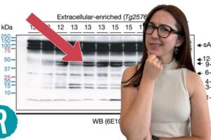 In June 2024, a groundbreaking Alzheimer's research paper was retracted over fraud allegations. Did this mean billions of dollars and countless hours of research were wasted? Maybe not. Today, two promising drugs targeting amyloid beta, the focus of the paper, are available. This video explains the amyloid-beta hypothesis, the fraud, and what’s next.