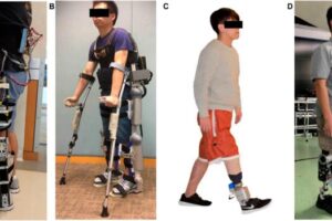 (A) Assistive knee brace, (B) CUHK-EXO, (C) ankle-foot prosthesis, and (D) transfemoral prosthesis