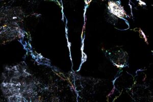 In the Drosophila brain, dormant neural stem cells with protrusions rich in actin filaments.