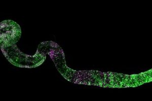 The intestine of the adult fruit fly, labeled with fluorescent markers.