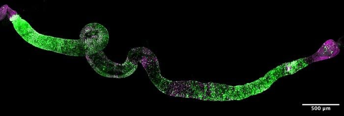 The intestine of the adult fruit fly, labeled with fluorescent markers.