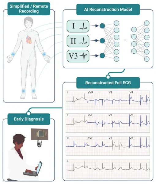 Researchers at Scripps Research have created a new way to check heart health. Instead of using the usual 12 sensors, they found that just 3 sensors, combined with a smart computer program, can spot heart problems almost as well. This simpler method could make it easier for more people to get their hearts checked.