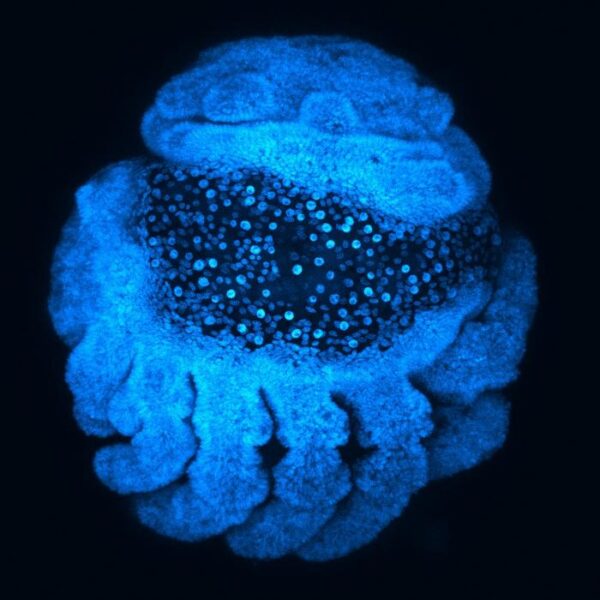 Spider embryo with a loss of the waist region upon knockdown of the gene waistless. Hoechst staining with fluorescent stereomicroscopy.