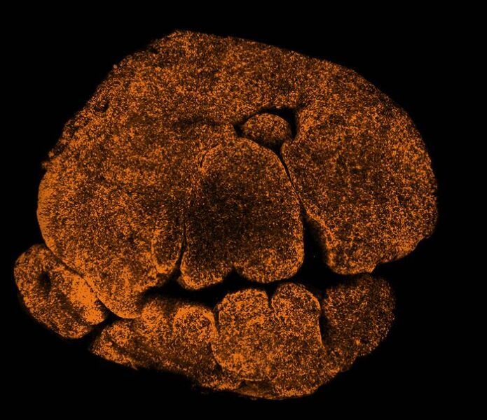 Reminiscent of a Halloween pumpkin, this collection of dots shows cells forming part of the thymus.