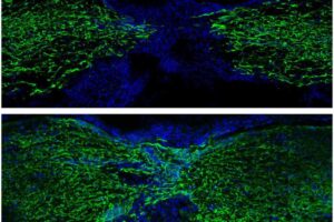 The top image shows fluorescently labeled cells in the spinal cord of a zebrafish recovering one week after an injury, and the bottom image shows recovery four weeks after an injury. Researchers at Washington University School of Medicine in St. Louis describe the dramatic changes within nerve cells that make regeneration possible. Such findings could inspire the development of new therapies for spinal cord injuries in people.