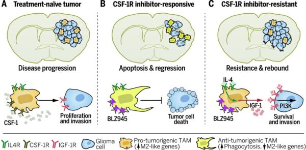 Breakthrough in Glioblastoma Research: Scar Tissue Linked to Tumor Recurrence