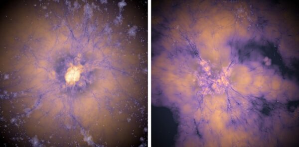 Early dark energy could resolve cosmology’s two biggest puzzles