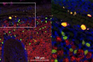 Fluorescence in situ hybridization (FISH) confocal microscopy image of deep-sea mussel tissue. The intranuclear parasite Ca. Endonucleobacter is shown in yellow, while beneficial symbiotic bacteria are labeled in green and red. Cell nuclei are stained blue. The right panel zooms in on the white square highlighted in the left panel.