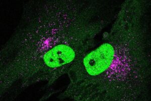 When the protein STING (pink) is activated, the transcription factor TFEB (green) is shuttled into the nucleus where it stimulates the production of lysosomes