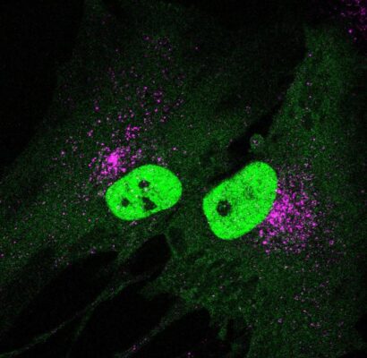 STING Protein Plays Dual Role in Cellular Health and Aging, Pitt Study Finds