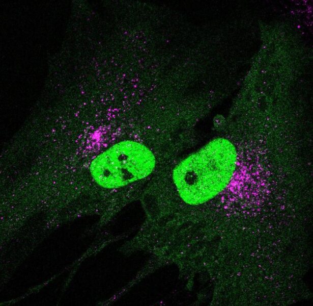 When the protein STING (pink) is activated, the transcription factor TFEB (green) is shuttled into the nucleus where it stimulates the production of lysosomes