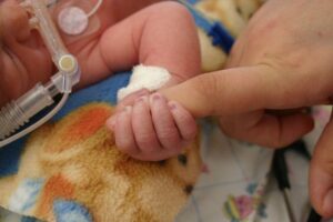 premature infant in hospital