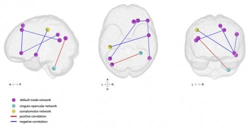 Restless sleep correlates with lower connectivity between the default mode network nodes, and default mode network and somatomotor network nodes. The default mode network is a group of brain regions that are active when we are at rest, not focusing on any specific task. The somatomotor network involves brain regions that are responsible for controlling movement and processing sensations from the body, such as touch and physical feedback.