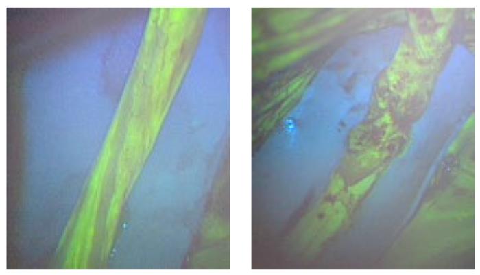 Fluorescein-enhanced contrast imaging shows a rabbit’s normal sciatic nerve, left, and a damaged one.