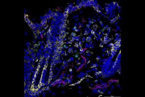 Immunofluorescence imaging showing nerve terminals (magenta) innervating keratinocytes (yellow) and myeloid cells (white) that express IL-33 (green) in naive murine skin. (Image: Courtesy of Camila Napuri)