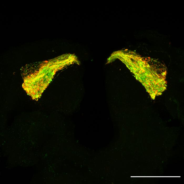 The brain of a 7-day-old fruit fly with Tau expressed in a neuronal circuit used by the fly in olfactory memory. The green outlines the neurons, which are starting to swell and degenerate due to the Tau protein. The red shows where Tau is building up in clusters along the neurons, starting to form the clumps that eventually become rope-like fibrils.