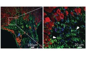 ENPP1 is expressed in the region of scarring after injury to the heart. Cardiac muscle shown in red and ENPP1 in green demonstrates expression of ENPP1 in the region of scar formation.