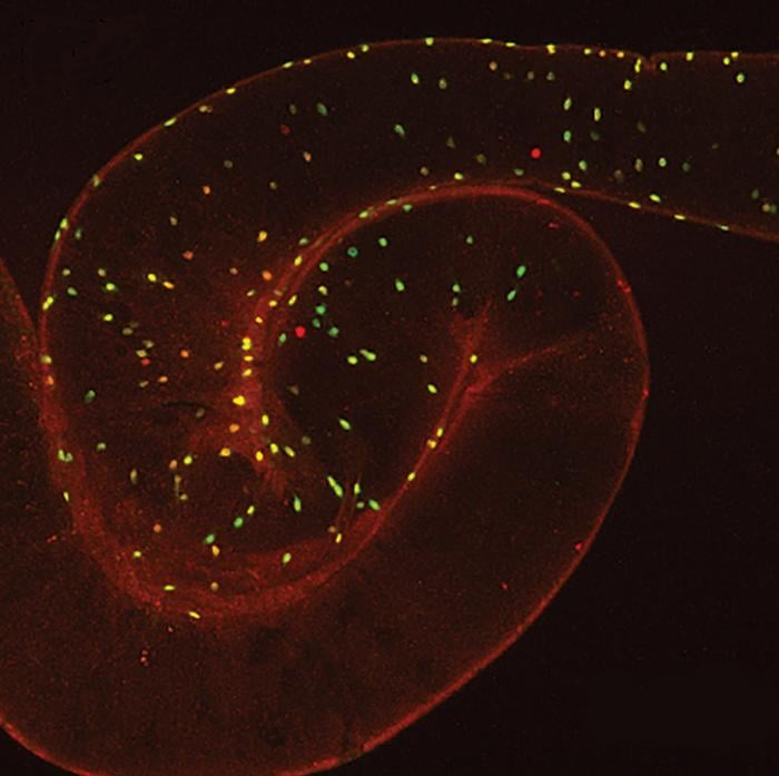 Pictures taken with a confocal microscope of the gut of drosophila (fruit fly) show enteroendocrine cells that express the NPF neuropeptide. Image courtesy of Marc Tatar.