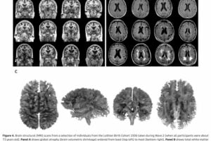 25-year study reveals key factors in healthy brain aging and cognitive performance