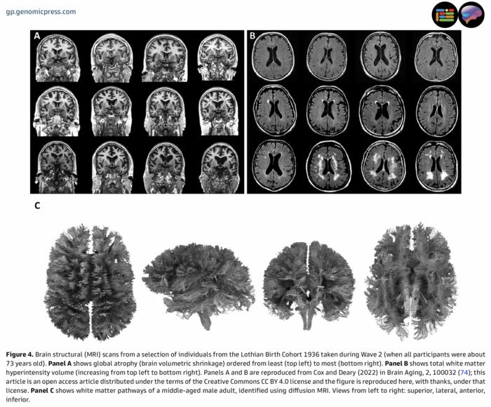 25-year study reveals key factors in healthy brain aging and cognitive performance