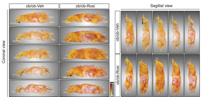 Figure 1 Adipose tissue remodeling after acute rosiglitazone treatment