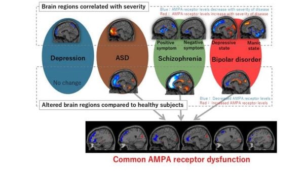 Breakthrough Brain Imaging Technique Reveals New Insights into Psychiatric Disorders