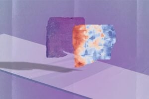 A new AI program, SEQUOIA, can analyze a microscopy image from a tumor biopsy (left, purple) and rapidly determine what genes are likely turned on and off in the cells it contains (gene expression shown in shades of red and blue on right).