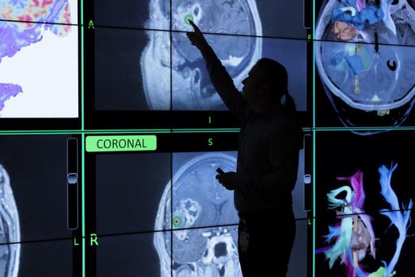 New AI Guidelines Aim to Standardize Brain Cancer Diagnosis