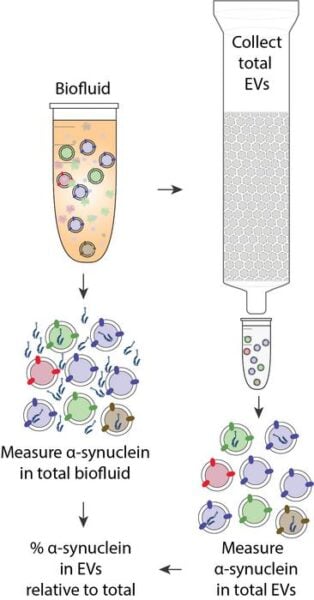 The team’s overall goal was to be able to compare the amounts of α-synuclein protein contained in extracellular vesicles (right side) relative to α-synuclein contained in total plasma (left side). To achieve the former, they innovated an already validated EV-isolation and analysis process with a critical “protein protection assay.”