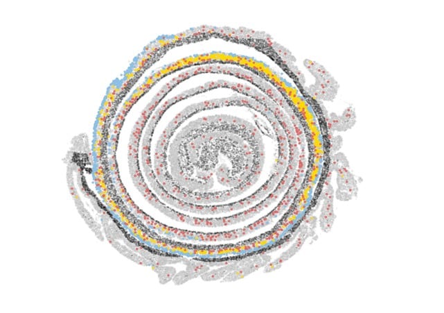  Xavier lab A map showing the distribution of different structural cell types in the colon. Fibroblasts are labeled in red, enterocytes in blue, and goblet cells in yellow.