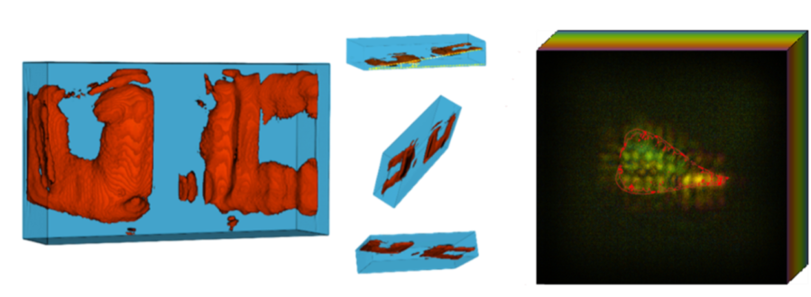 New X-ray Tech Captures 3D CT Images in a Single Shot, Cutting ...