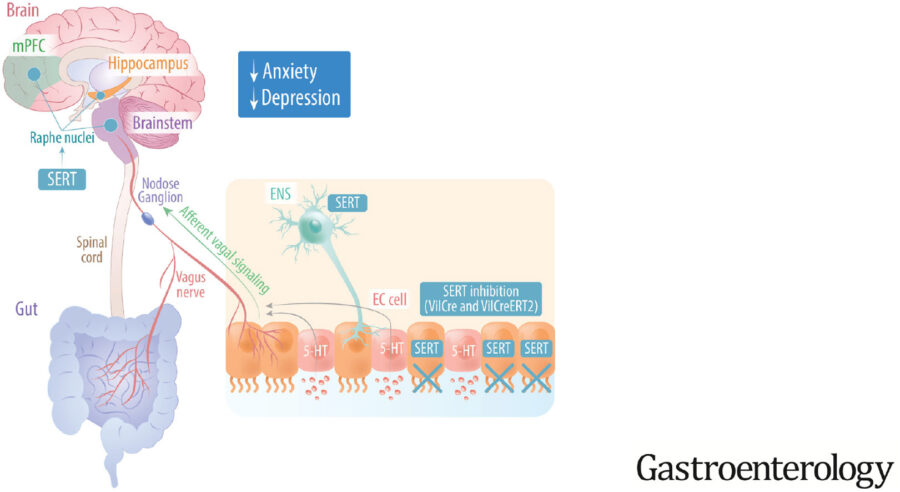 Brain gut axis in depression and anxiety infographic