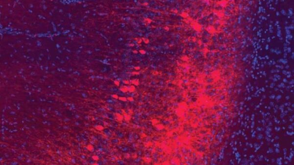 Researchers find brain signature of resilience, suggesting new way to treat depression