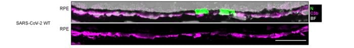 A cross-section of the retinal pigment epithelium in an ACE2-expressing mouse infected with SARS-CoV-2. Top image: Bright-field view with immunofluorescence showing SARS-CoV-2 N-protein (green) and complement component C3b (magenta). Bottom image: Immunofluorescence of C3b alone. Widespread C3b accumulation is visible, even though N-protein expression is limited to two small regions. Scale bars: 50 µm.