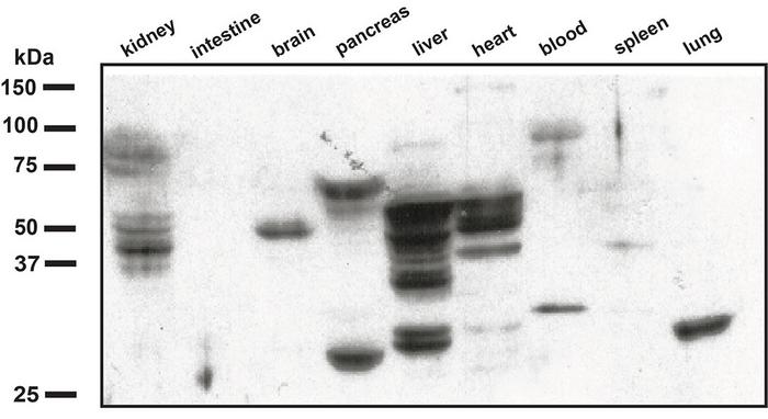 Novel Blood Test Could Reveal Hidden Inflammation in Heart Disease and Alzheimer’s