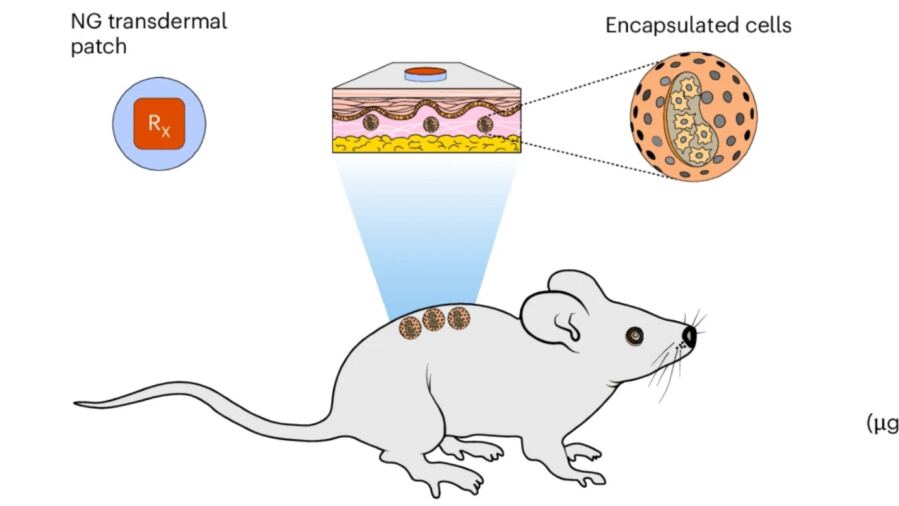 Simple Skin Patch Could Control Next-Gen Cell Therapies for Diabetes