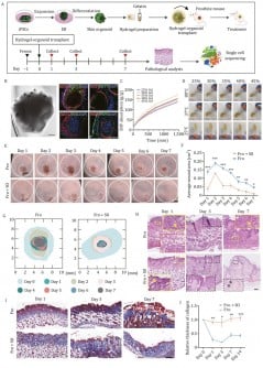 Penyembuhan Frostbite Tanpa Bekas Luka: Janji Organoid Kulit