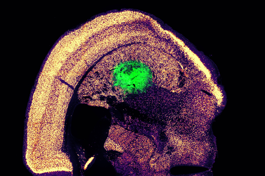 Scientists Crack Code to Transform Skin Cells Directly into Neurons