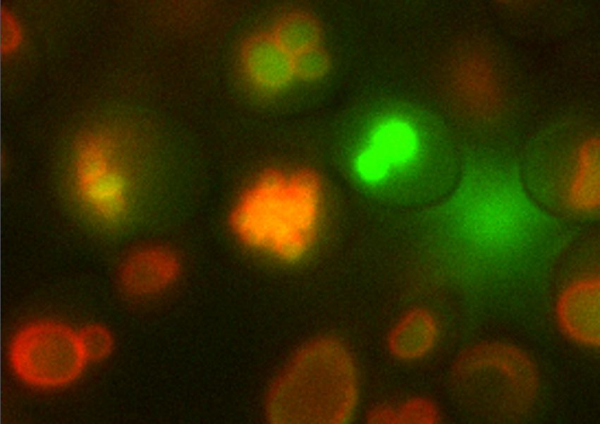 These optical microscopy images show the osteoyeast cells. The outline of the vacuole, the cellular organelle where calcium is accumulated to form hydroxyapatite, is fluorescing red. The calcium inside the vacuole is fluorescing green. (Credit: Behzad Rad/Berkeley Lab)