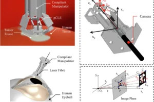 Infographic about new eye robot
