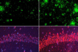 Top row: In a mouse model of Alzheimer's disease, lithium deficiency (right) dramatically increased amyloid beta deposits in the brain compared with mice that had normal physiological levels of lithium (left). Bottom row: The same was true for the Alzheimer’s neurofibrillary tangle protein tau. Images: Yankner Lab