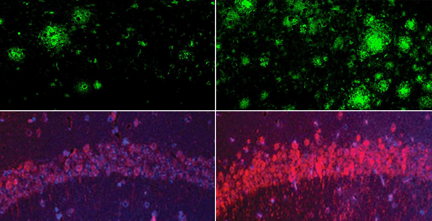 How Lithium Loss May Ignite and Reverse Alzheimer’s How Lithium Loss May Ignite and Reverse Alzheimer’s