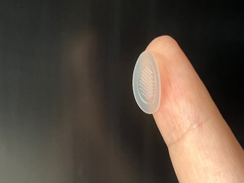 This new pimple patch features a specialized array of tiny spikes to help deliver acne-busting compounds under the skin.