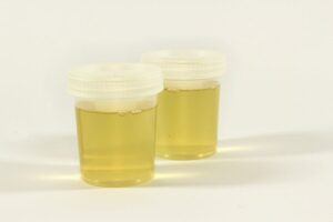 two urine samples