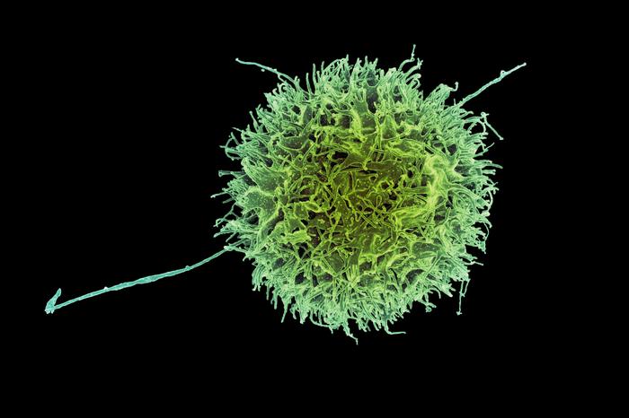 A new study identifies genetic modifications that make “natural killer” more effective at destroying cancer cells.